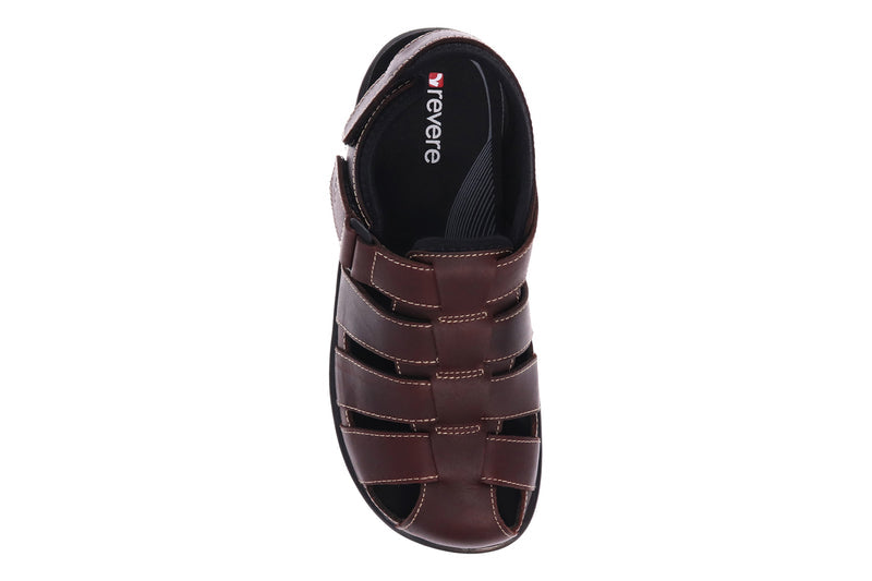 bunions